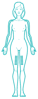 Step 4 illustration