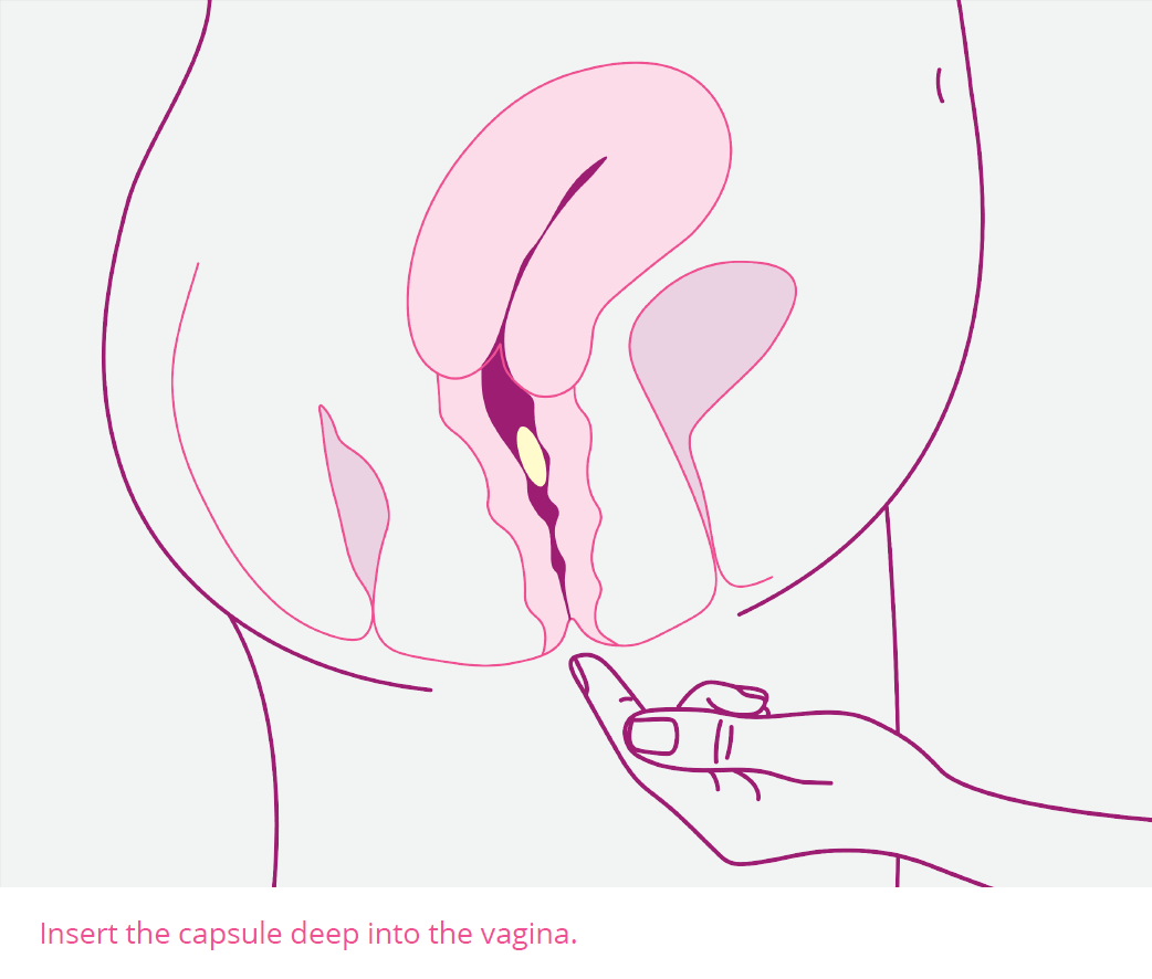 new-vag.png